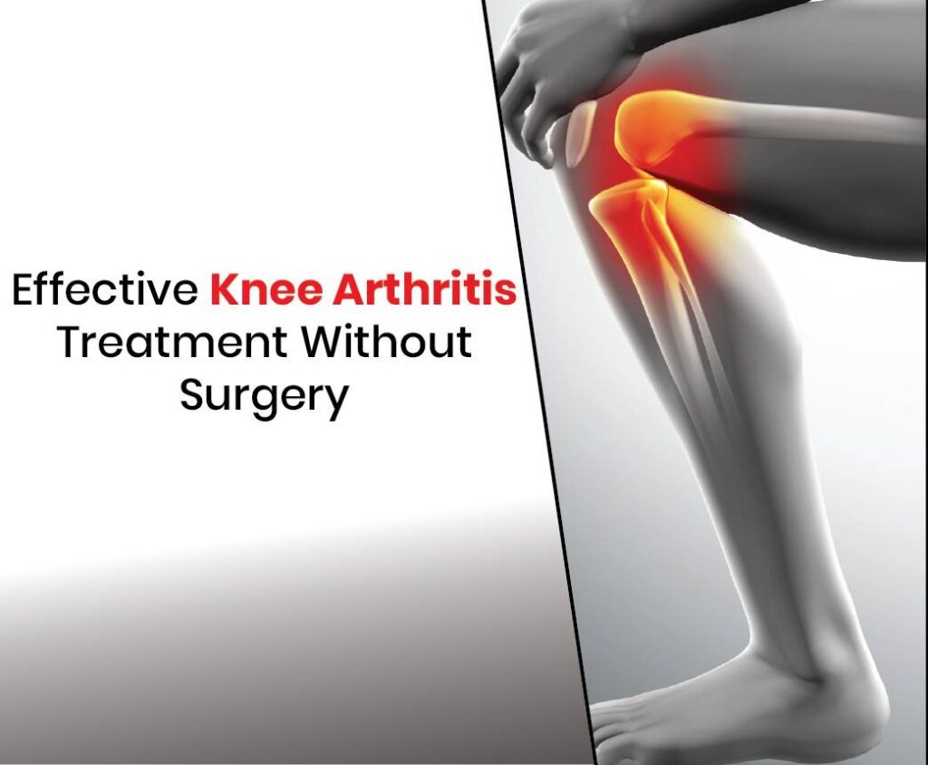 Effective knee arthritis treatment without surgery