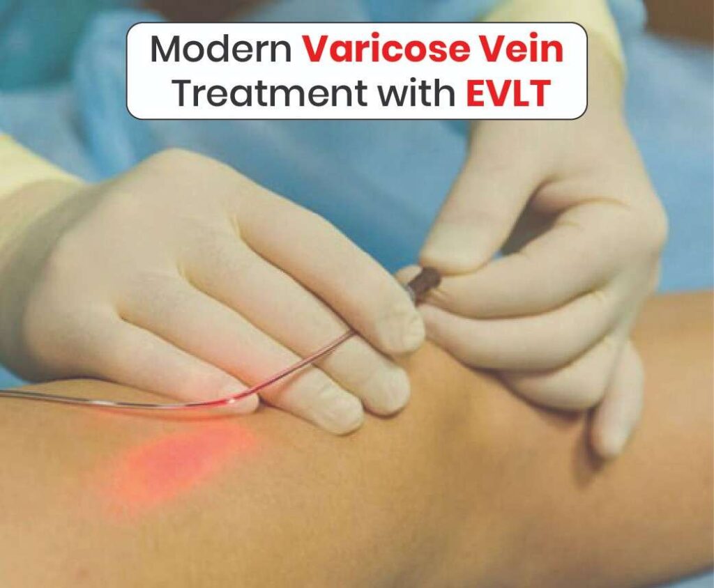 Modern Varicose Vein Treatment with EVLT