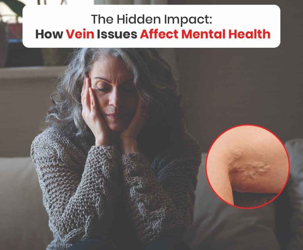 The Hidden impact how vein issues affect mental health