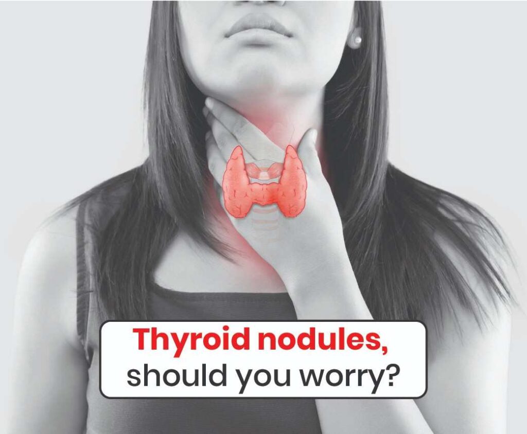 thyroid nodules should you worry