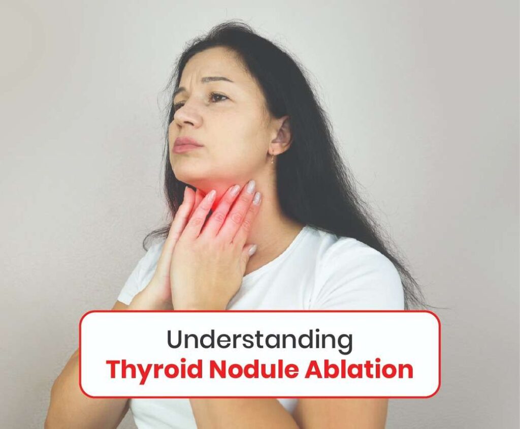 understanding thyroid nodule ablation