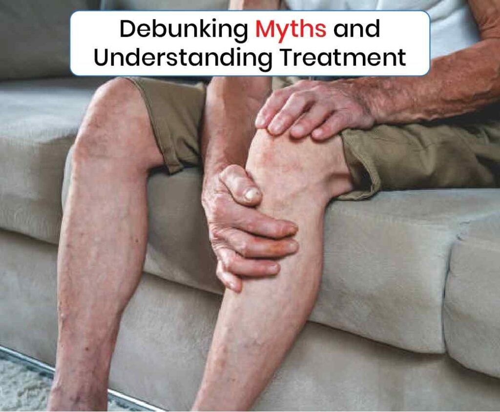 Debunking Myths and Understanding Treatment