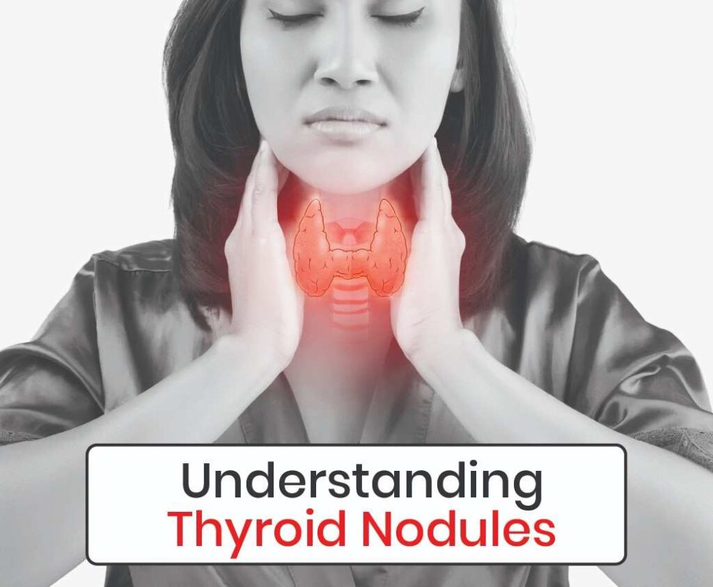 Understanding Thyroid Nodules