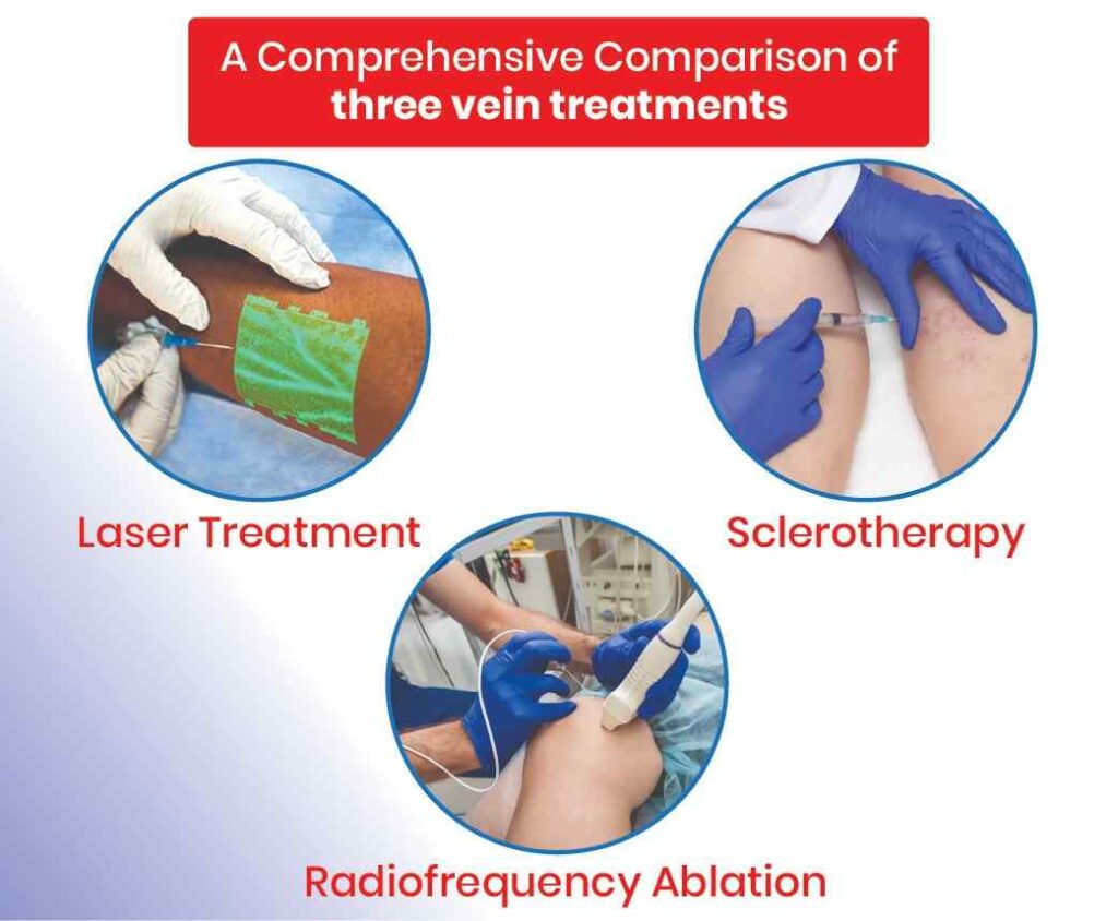 comprehensive comparison of three vein treatments