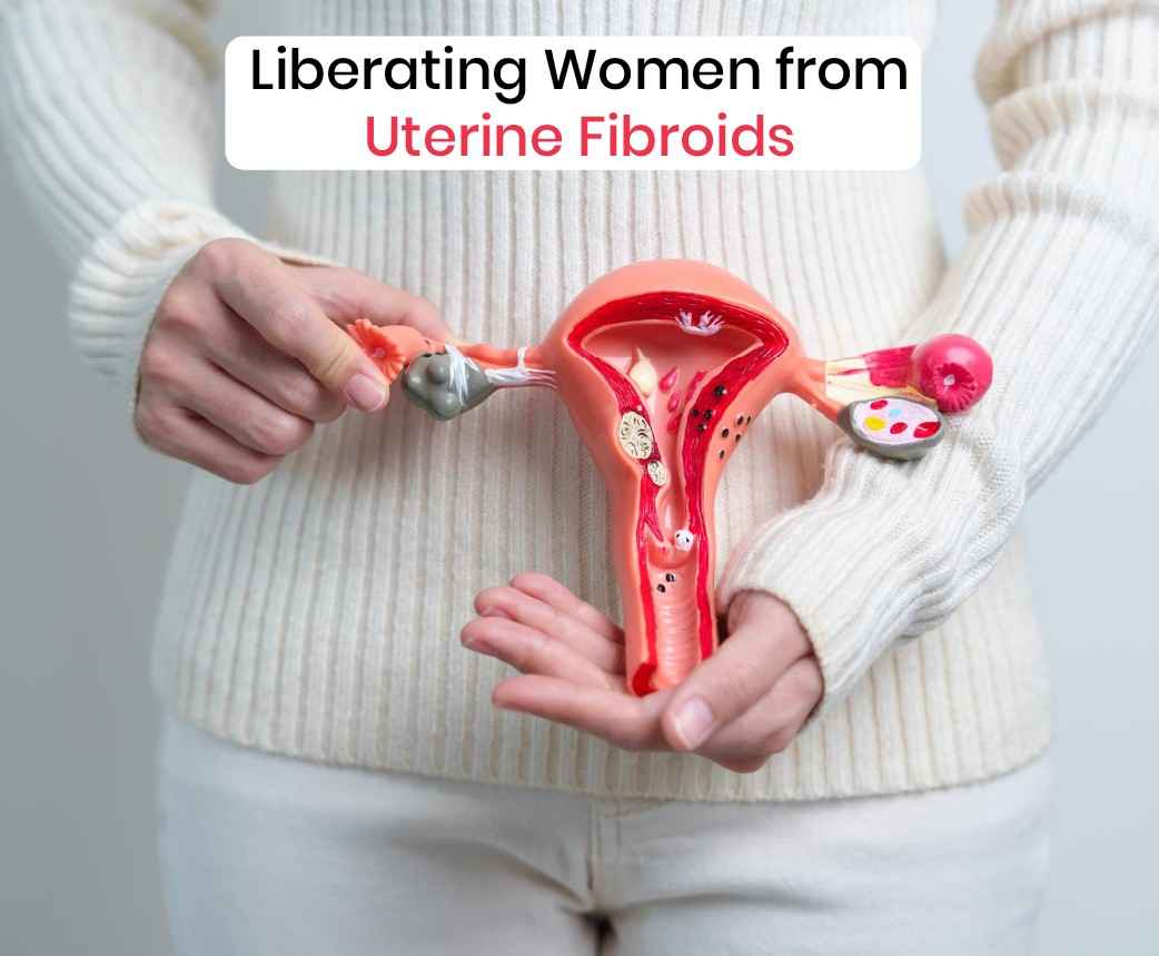 liberating women from uterine fibroids