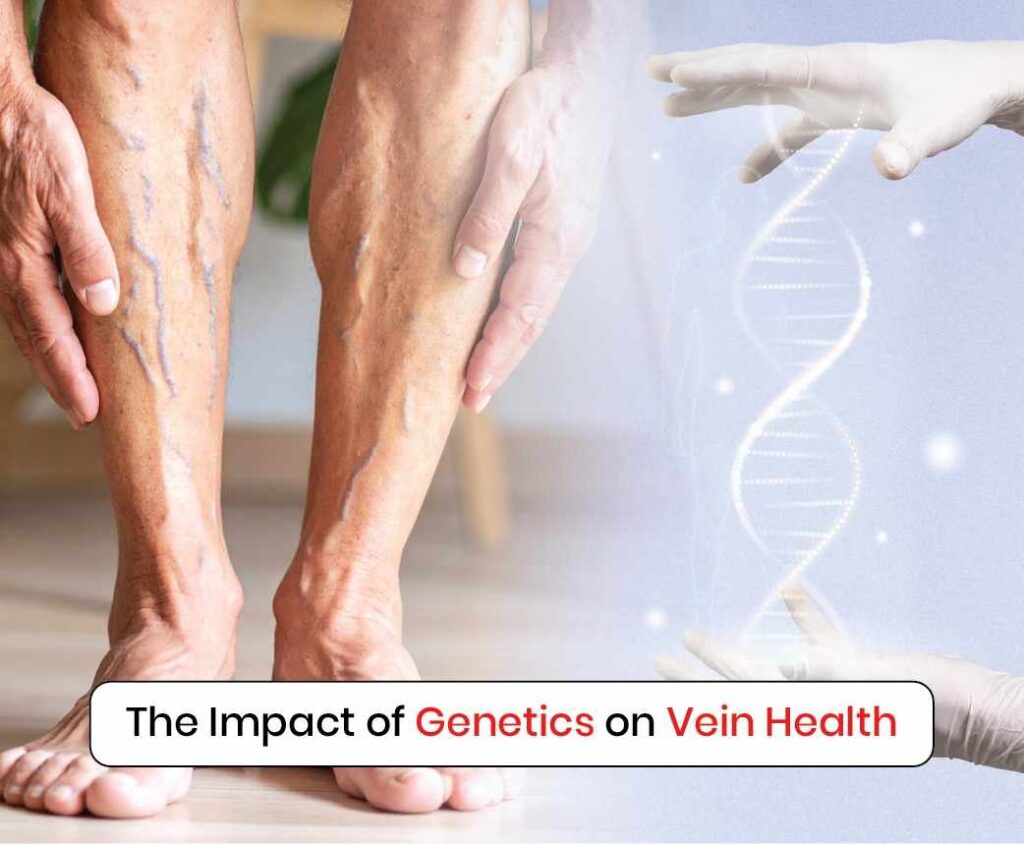 the impact of genetics on vein health