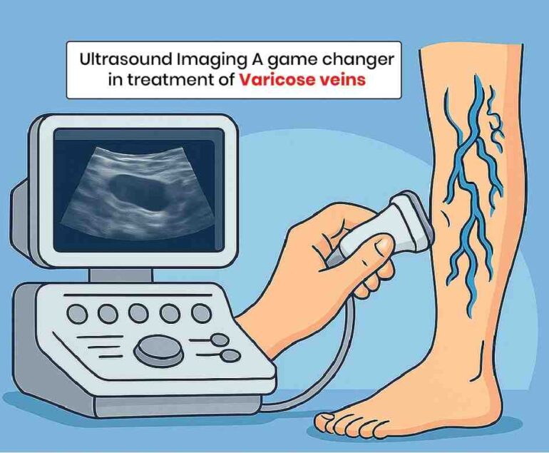 ultrasound imaging a game changer treatment for varicose veins
