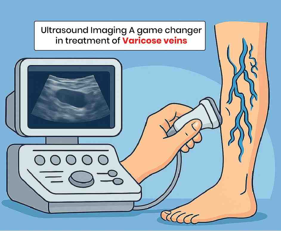 ultrasound imaging a game changer treatment for varicose veins