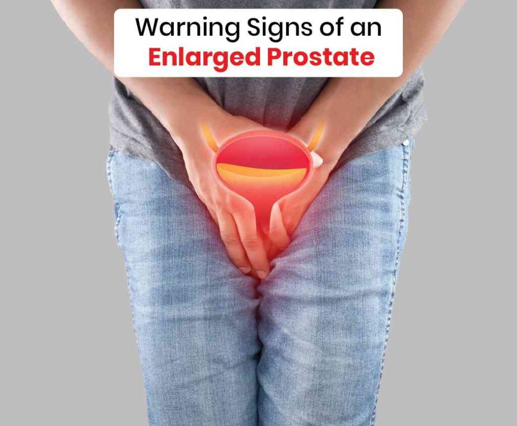 warning signs of an enlarged prostate