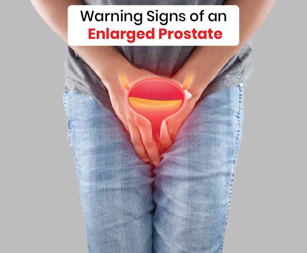 warning signs of an enlarged prostate