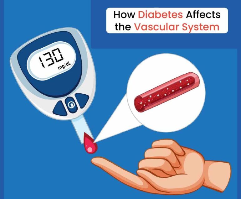How diabetes affects the vascular system