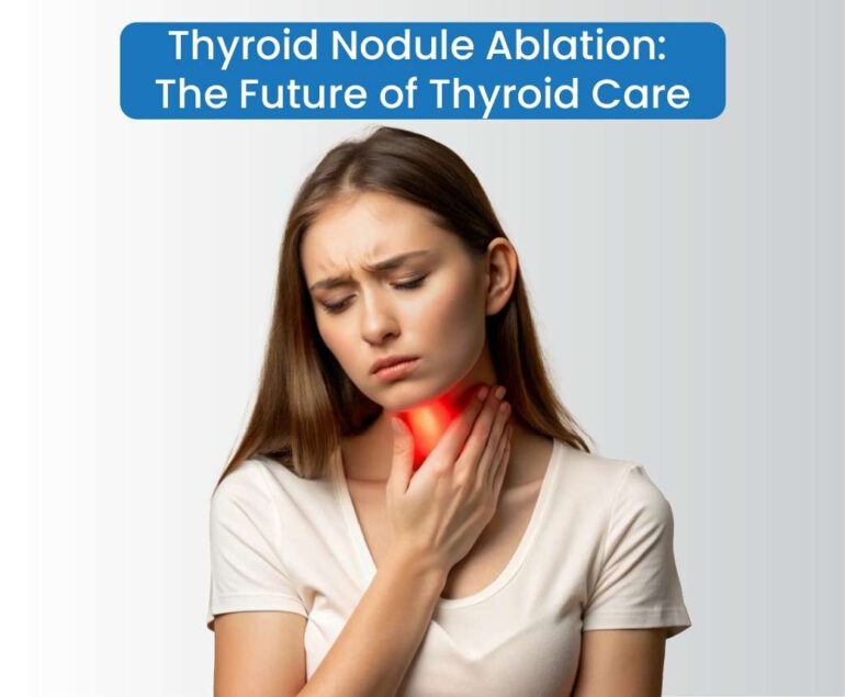 The Thyroid Nodule Ablationthe future of thyroid care