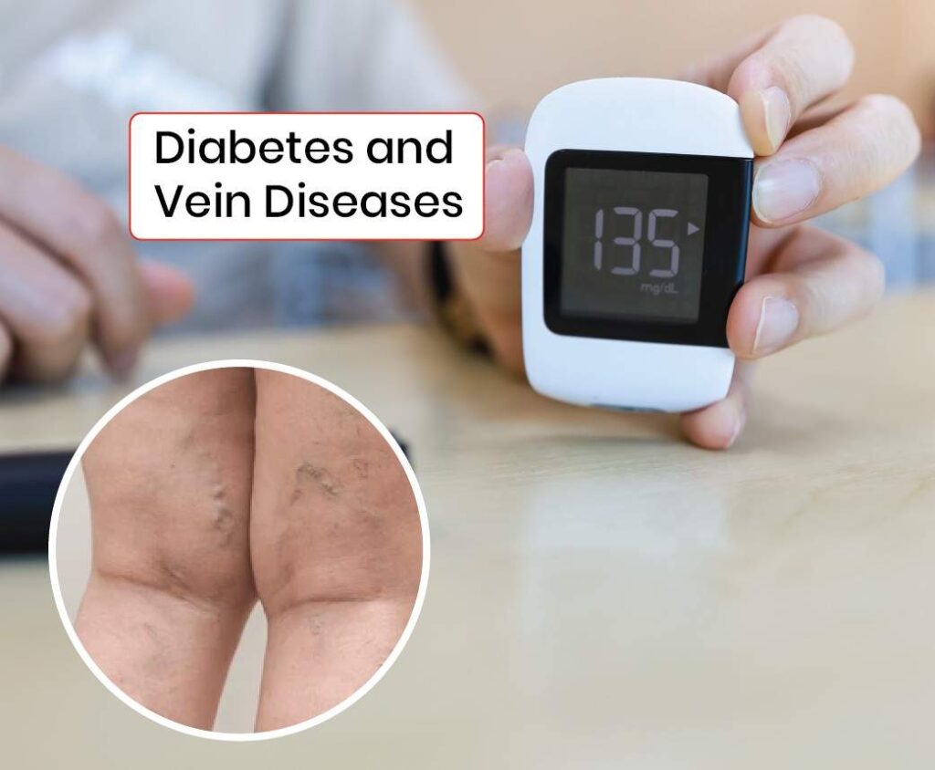 diabetes and venous diseases