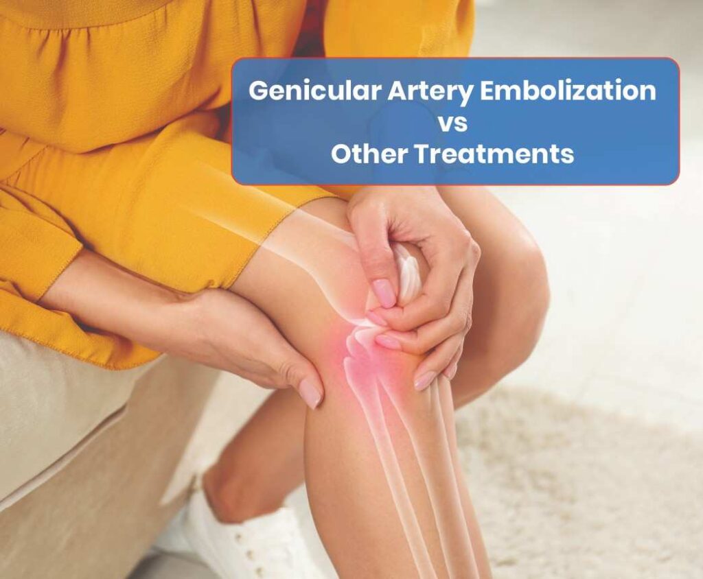 genicular artery embolization vs other treatments