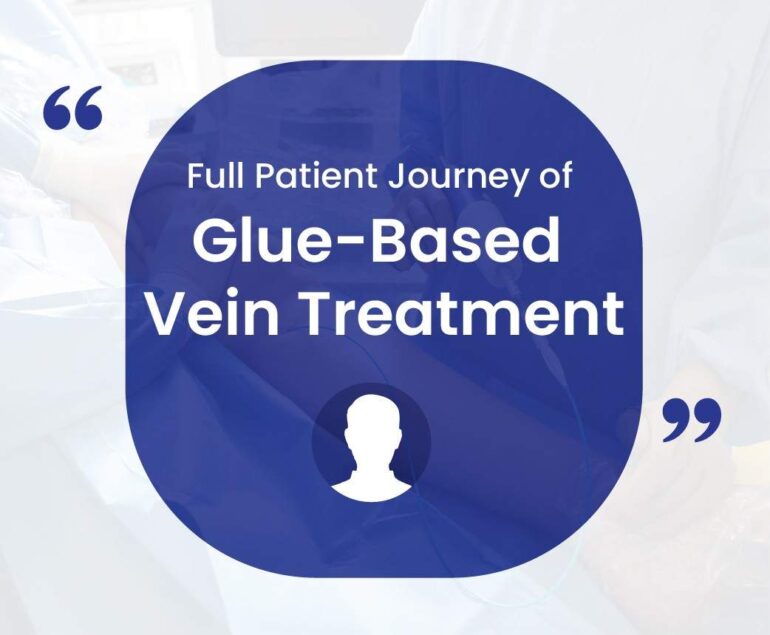 full patient journey of glue based vein treatment