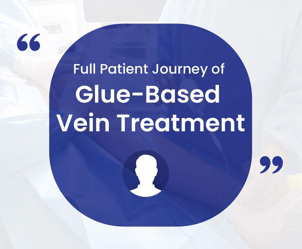 full patient journey of glue based vein treatment