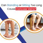 can standing or sitting too long cause varicose veins