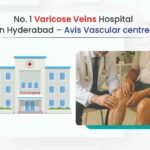 no 1 varicose veins hospital in hyderabad