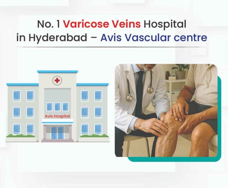 no 1 varicose veins hospital in hyderabad